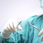 包茎手術の費用は100万円することも！費用を安くするポイントを徹底解説